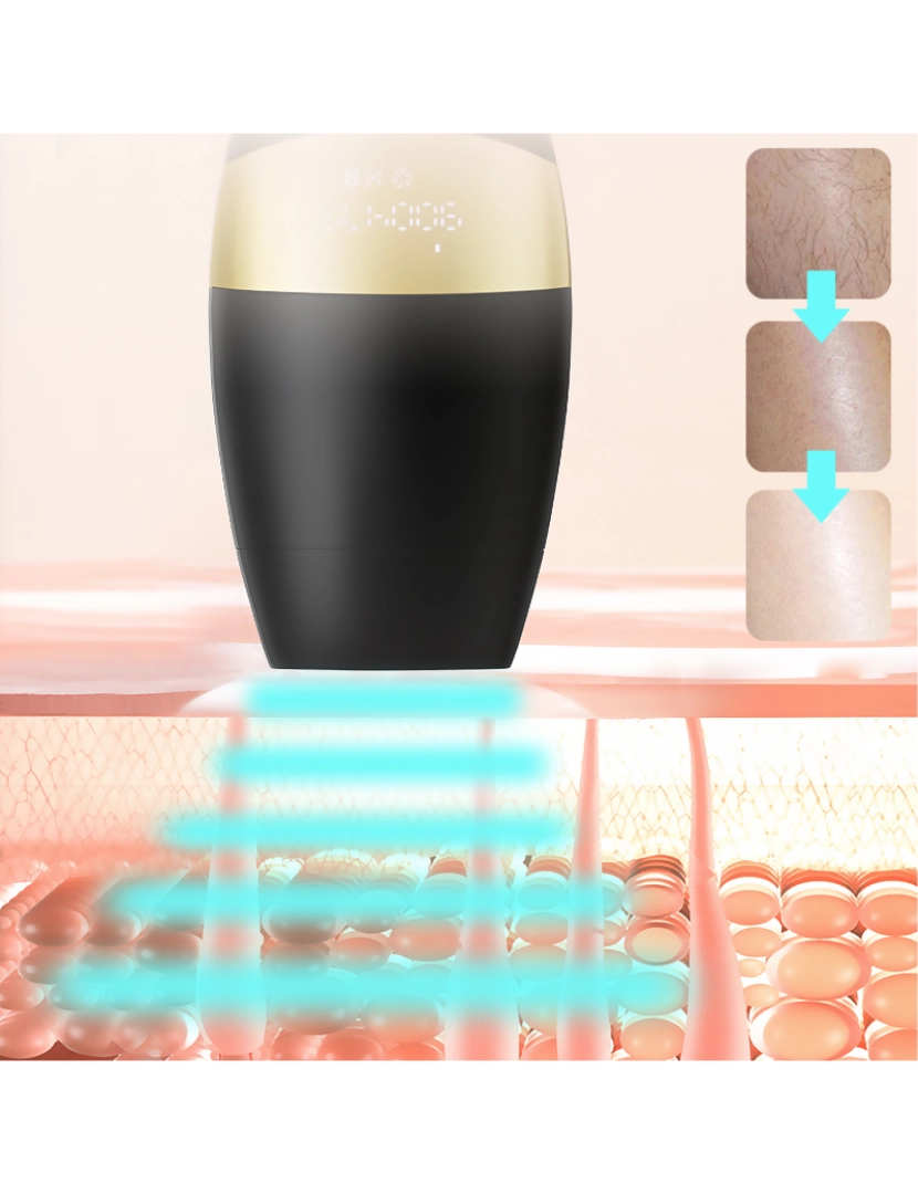 imagem de DAM. Instrumento de depilação com luz colorida. Tubo de lâmpada de quartzo.2