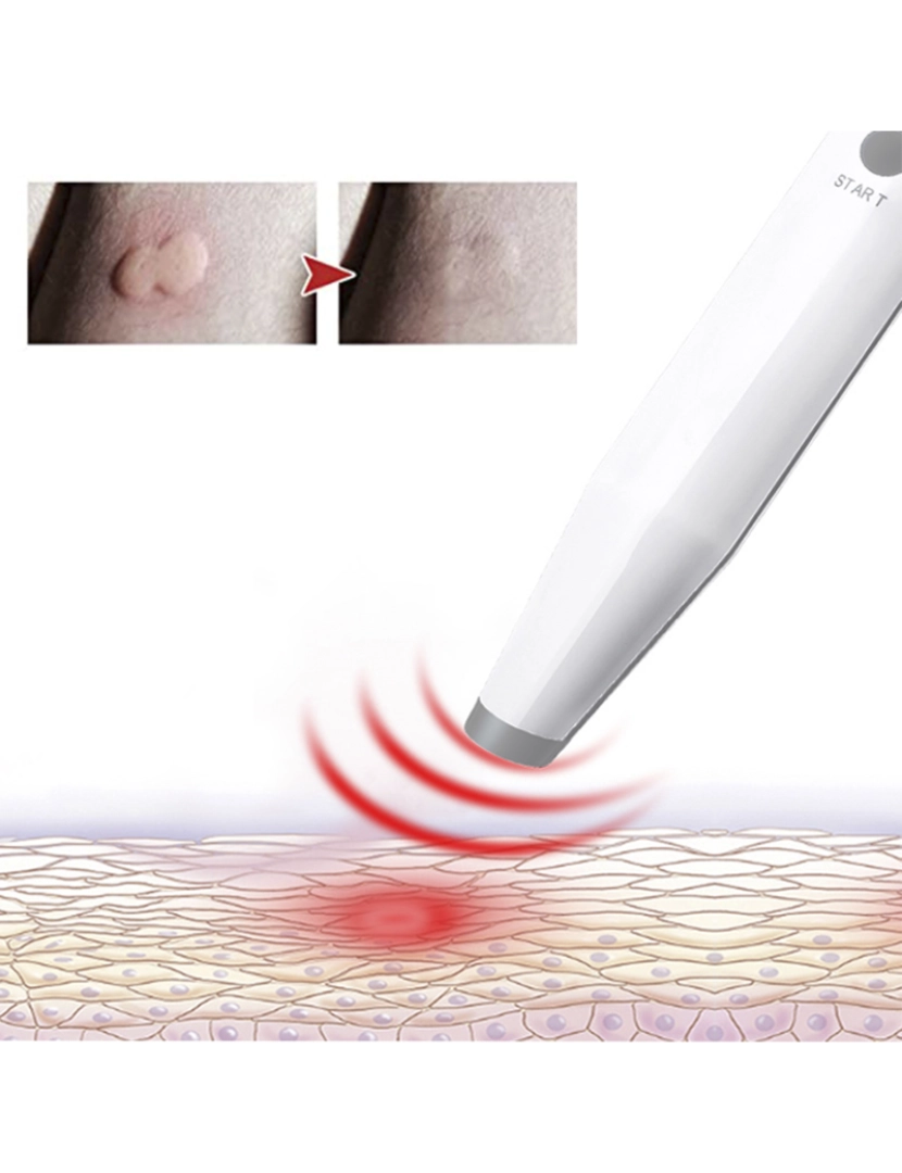 imagem de DAM. Alívio de picadas de insetos e picadas. Percevejo eletrônico e ferramenta de alívio de picada de mosquito.5