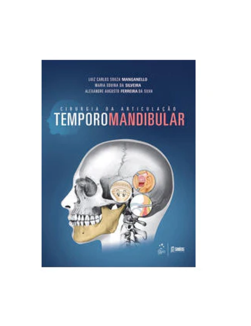 imagem de Livro, Cirurgia da Articulação Temporomandibular 1/141