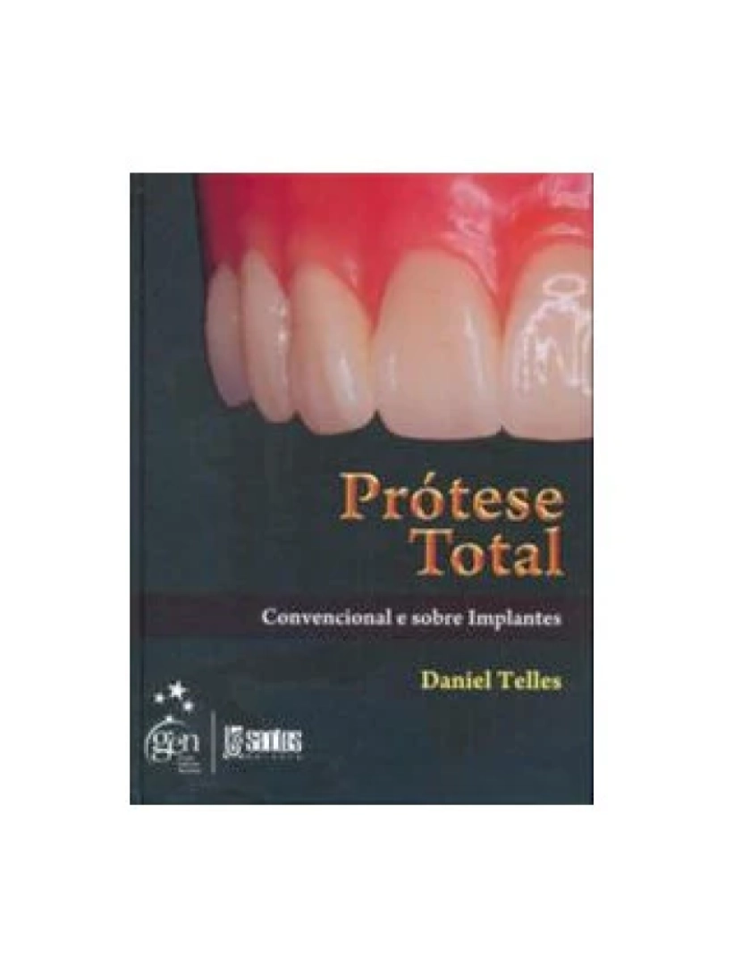 Santos - Livro, Prótese Total Convencional e sobre Implantes1/09