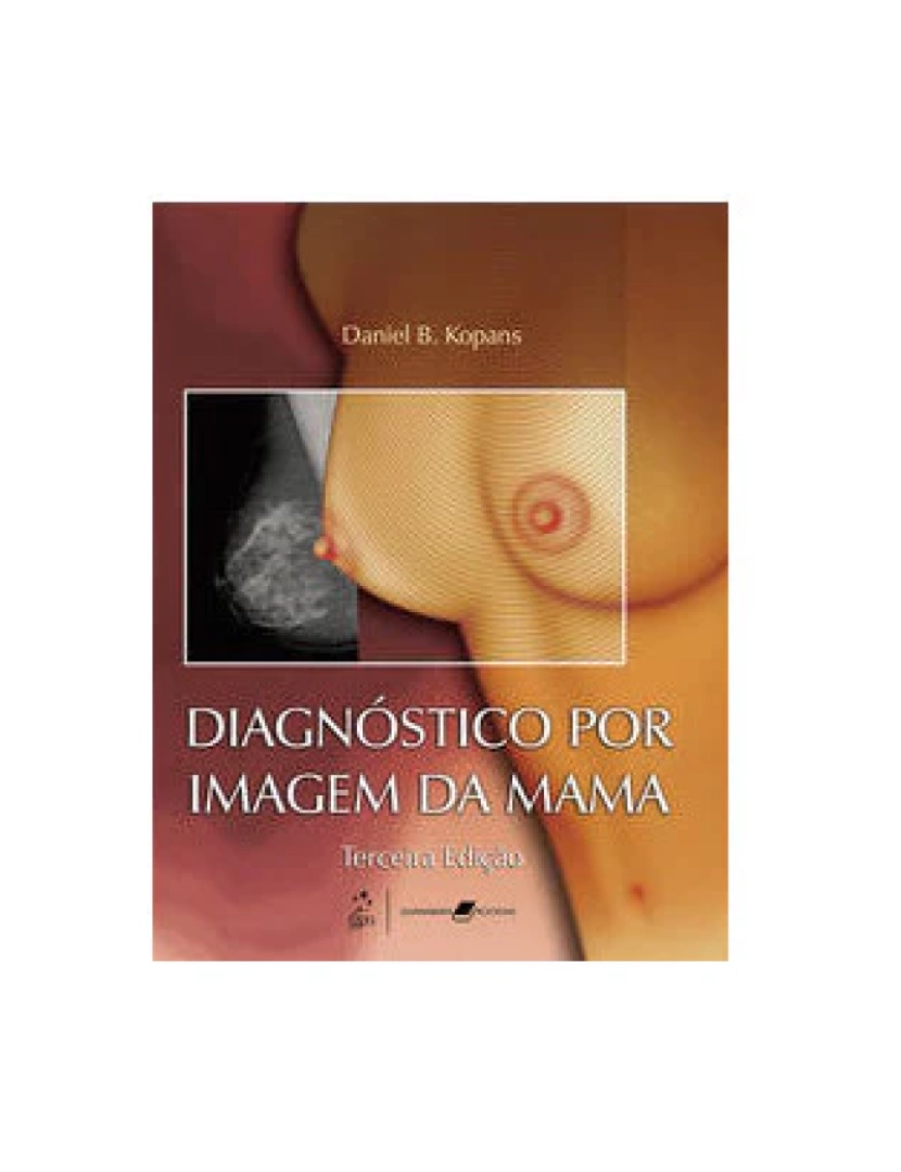 imagem de Livro, Diagnóstico por Imagem da Mama 3/081