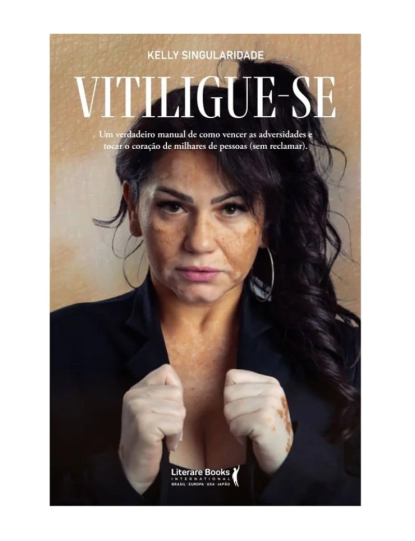 Literare Books - Vitiligue-se - de Kelly Singularidade