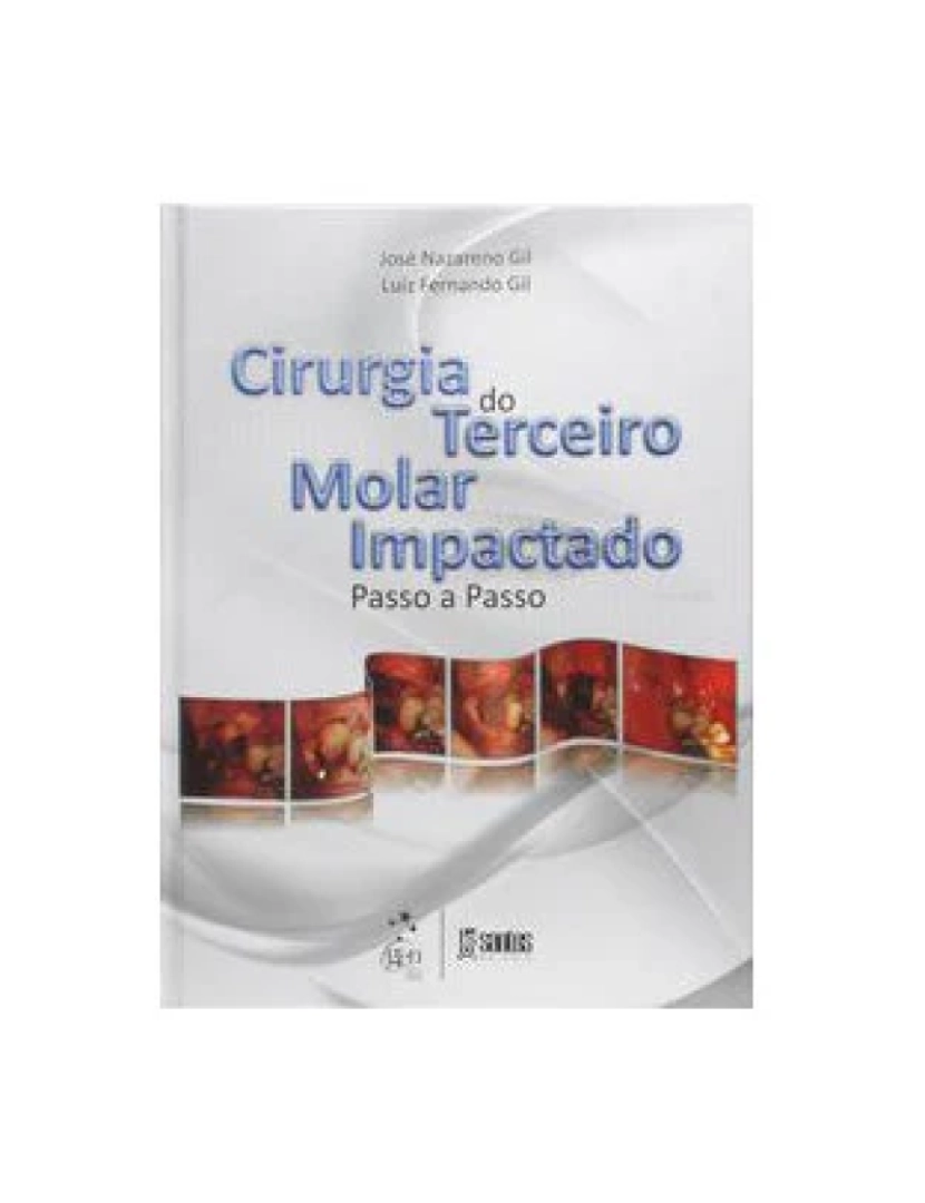 Santos - Livro, Cirurgia do Terceiro Molar Impactado Passo a Passo 1/12