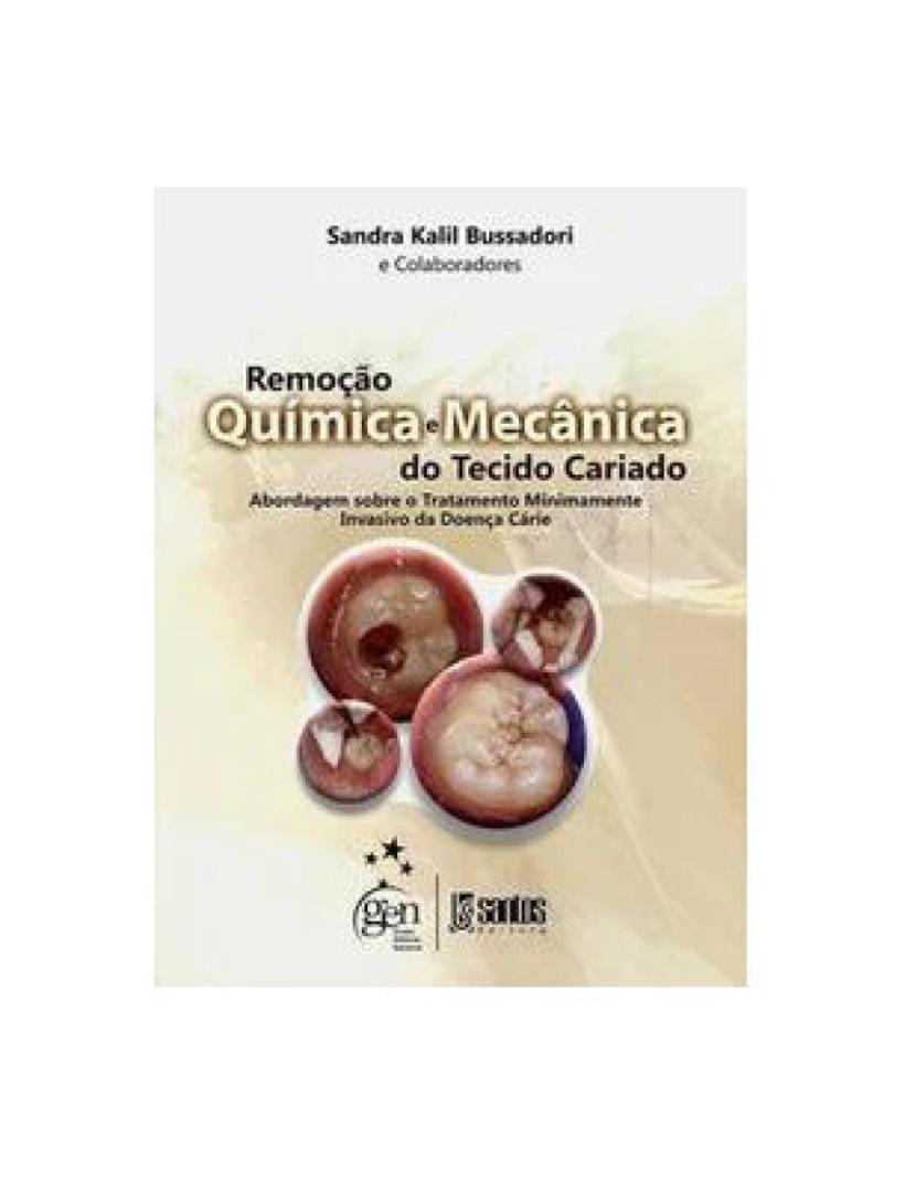 imagem de Livro, Remoção Química e Mecânica do Tecido Cariado 1/101