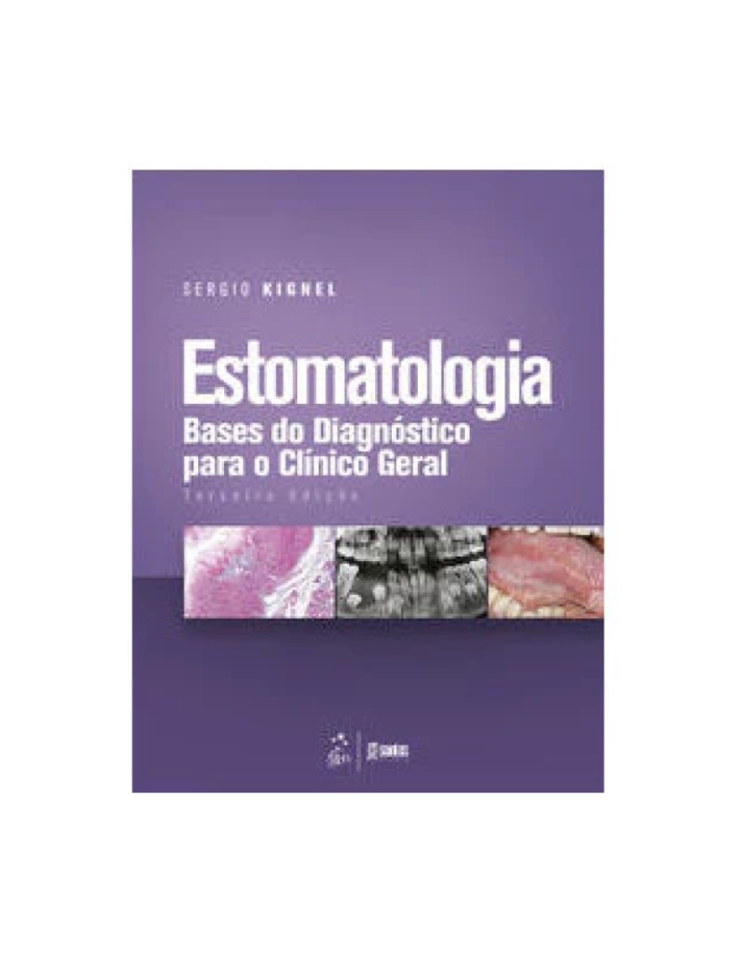 Santos - Livro, Estomatologia Bases do Diagnóstico para o Clínico Geral 3/20