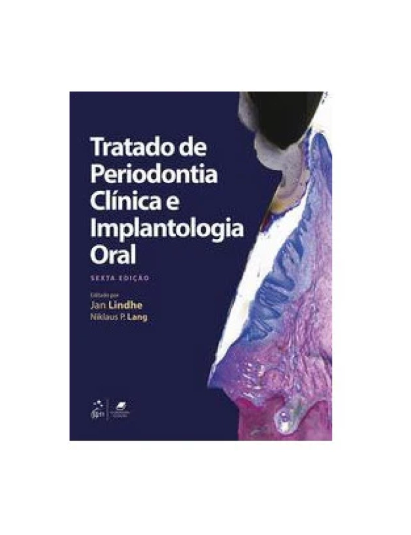 imagem de Livro, Tratado de Periodontia Clínica e Implantologia Oral 6/181