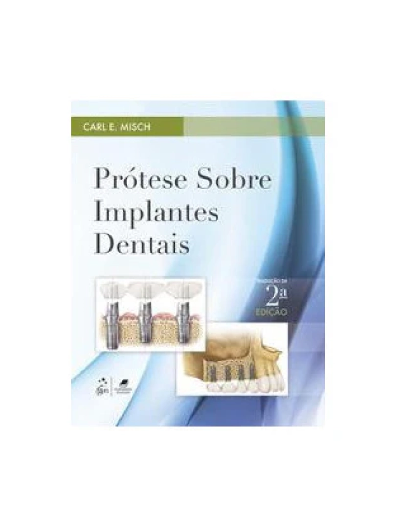 imagem de Livro, Prótese Sobre Implantes Dentais 2/151