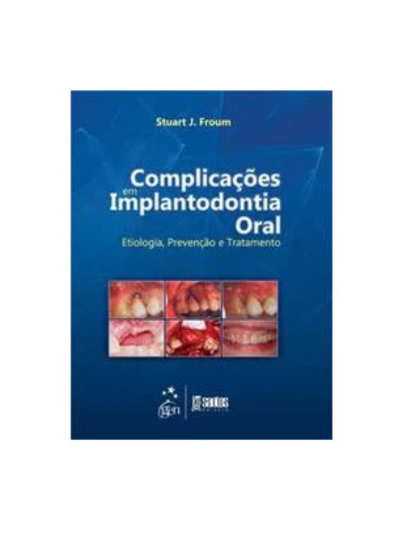 Santos - Livro, Complicações em Implantodontia Oral Etiologia Prev Trat 1/13