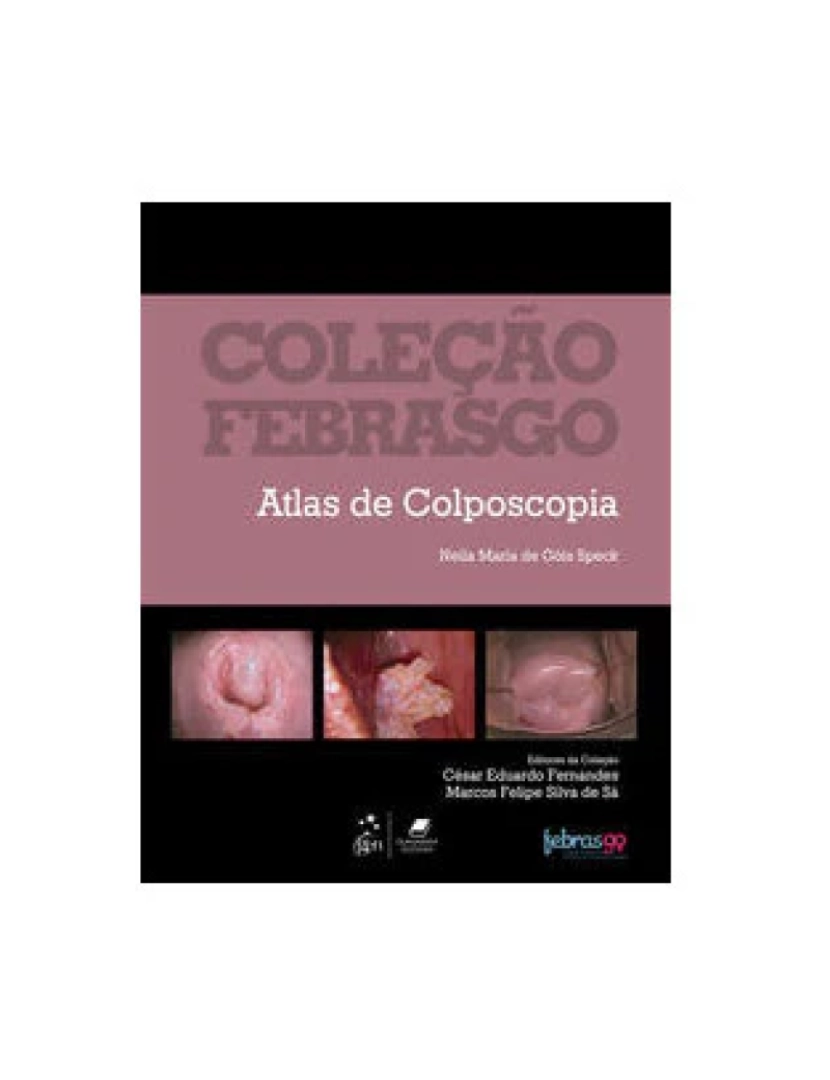 Elsevier - Livro, Atlas de Colposcopia (Febrasgo) 1/19