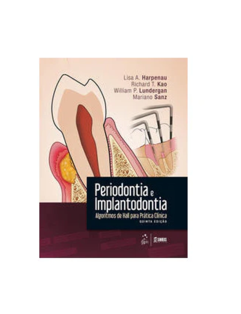 imagem de Livro, Periodontia e Implantodontia Algoritmos Hall Prát Clíni 5/161