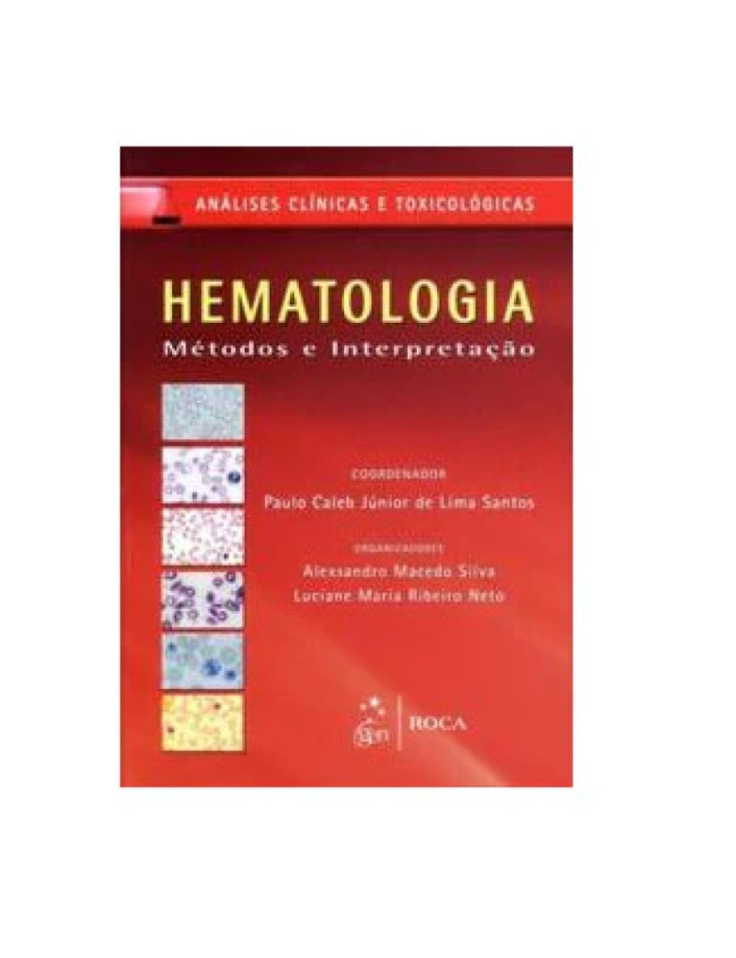 imagem de Livro, Hematologia Métodos e Interpretação 1/121