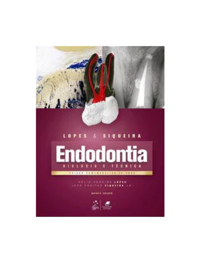 Elsevier - Livro, Endodontia Biologia e Técnica 5/20
